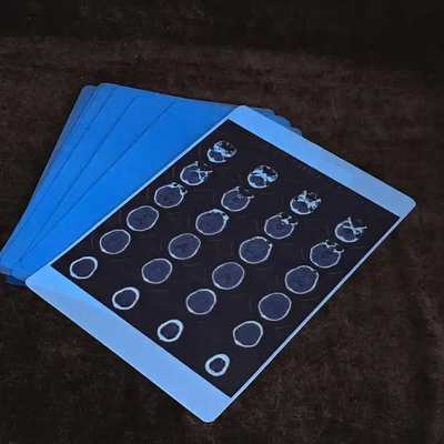 Impressora térmica médica seca Impressora CT Filme a jato de tinta Azul A4 PET Equipamento médico ortopédico Filmes de raios X
