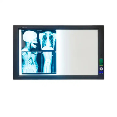 Película de raios X Médicos Azul para impressoras a jato de tinta com alta nitidez e baixo nevoeiro