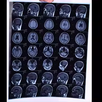 Filme de raios X Médico Termal Seco Para Impressora