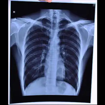 Filme de jato de tinta médico de raios-X com qualidade de imagem clara