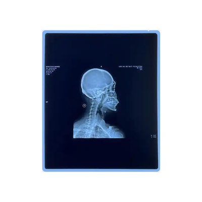 Filme de jato de tinta médico de raios-X com qualidade de imagem clara