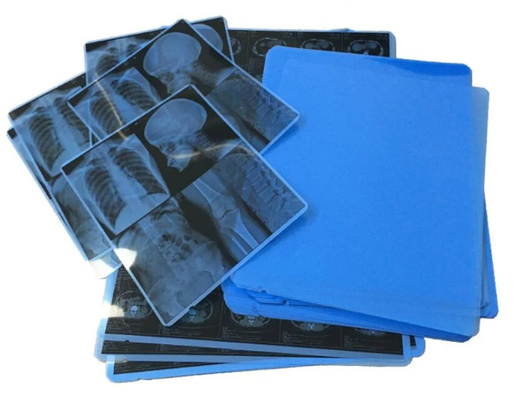 Filme de raios X Médicos Azuis para impressoras a jato de tinta e imagens claras e precisas