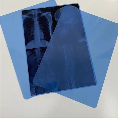 Impressão a jato de tinta PET Laser Seco de Raios X Film Base Azul Transparente para Imagem de Diagnóstico