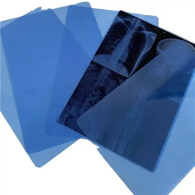 Impressão a jato de tinta PET Laser Seco de Raios X Film Base Azul Transparente para Imagem de Diagnóstico
