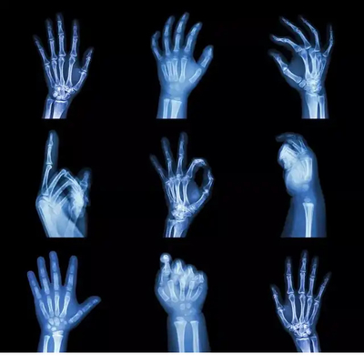 Impressão a jato de tinta PET Laser Seco de Raios X Film Base Azul Transparente para Imagem de Diagnóstico