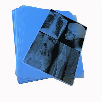 Imagens médicas de filmes de raios X de jato de tinta térmico baseado em PET azul para hospitais clínicos