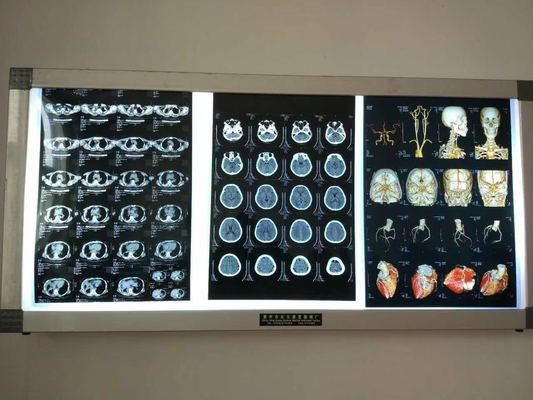 Imagem de filme seco à prova d'água de raios X para dispositivos médicos Impressão a jato de tinta a laser