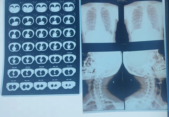 Sistema de Imagem Médica Laser Raios X Filme Seco Para DR CR MRI Impressora de Raios X Com ISO CE