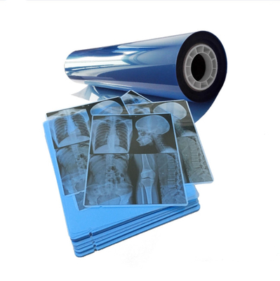 Jato de tinta de filme médico azul para resultados consistentes de imagem de raios-X