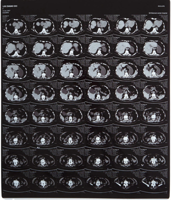 Filme de raios X Médicos de alta clareza FUJI DIHT 14*17in Laser Dry Imaging Film