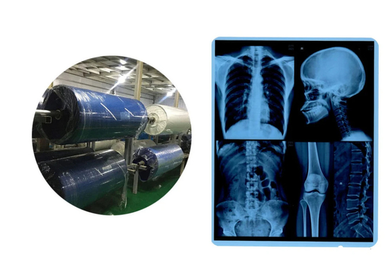 Rolos de filme médico de raios-X de jato de tinta Base azul para CR DR CT IRM Imagem de saída