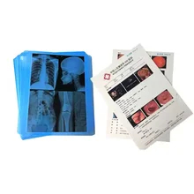 Jato de tinta de filme médico de alta resolução para imagens de diagnóstico claras e detalhadas