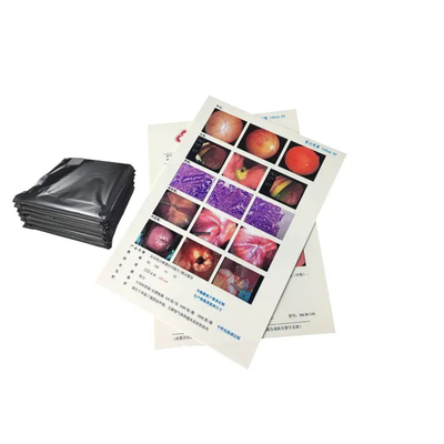 PET Film Base Azul Transparente Cor Filmes de Raios X Médicos para Diagnóstico de Raios X
