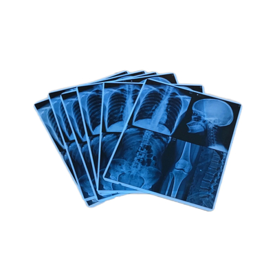Alta estabilidade de imagem Tinta de filme médico azul para filme de raios-X