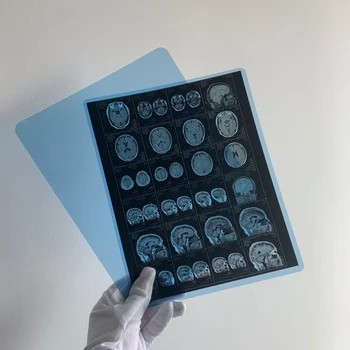 Filme seco médico de raios X Filme a jato de tinta de raios X médico com qualidade de imagem clara