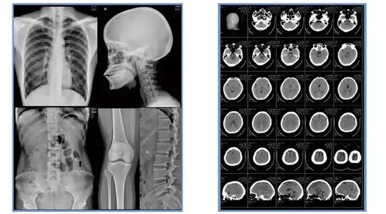Blue Inkjet Medical X Ray Film Medical Dry Film Folha A4 ou em rolo Não há comentários ainda