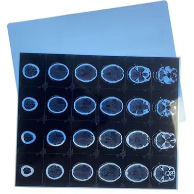 Impressões a jato de tinta para imagens médicas com filme médico de raios-X azul
