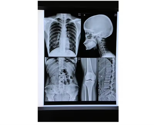 Blue Inkjet Medical X Ray Film Medical Dry Film Folha A4 ou em rolo Não há comentários ainda