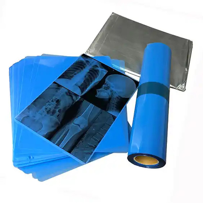 Impressões a jato de tinta para imagens médicas com filme médico de raios-X azul