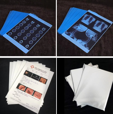 Impressora de jato de tinta à prova d'água profissional Epson Filme de raios X Para Impressão de tinta à base d'água