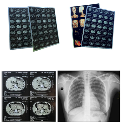 Folhas de tamanho A4 Filme médico de jato de tinta azul para imagem médica