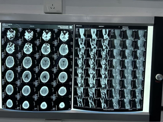 Filme de raios-X de laser de diagnóstico de densidade aumentada 0.28D para equipamentos médicos
