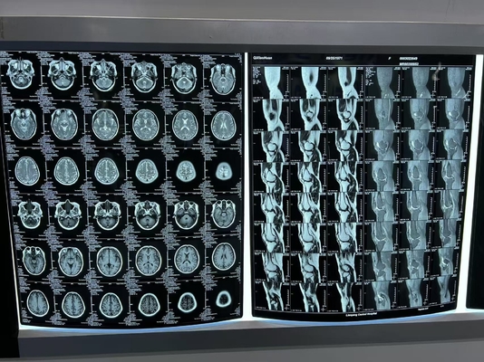 Impressão térmica azul de filme de raios X de laser médico para diagnóstico preciso