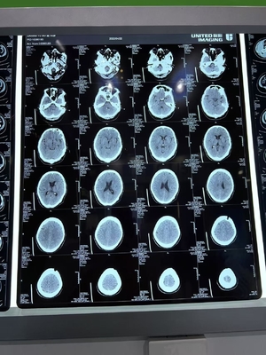 3.0D Contraste Superior Flexibilidade Laser Seco Filme de Raios X Para Médico