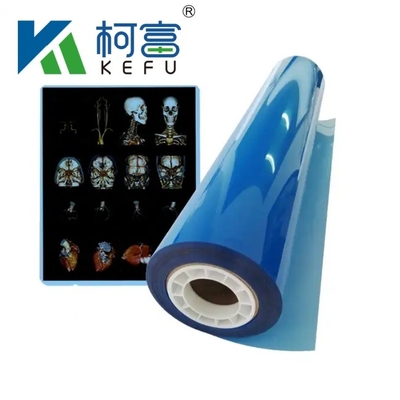 Filme de raios-X Médicos de Fábrica Azul Filme de raios-X Médicos Sensíveis
