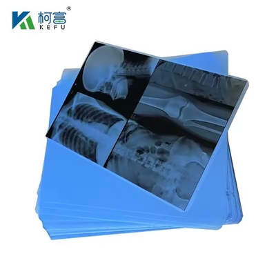 A4 Tinta Médica Jet Blue Film X-Ray PET Film X-Ray Paper