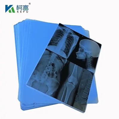 Embalagem Farmacêutica Grade Clear PVC Plastic Film Roll For Blister
