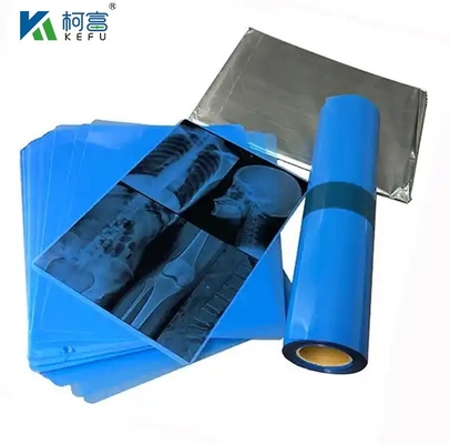 Imagens médicas de filme térmico/jet de tinta baseado em raios X PET azul para clínicas e hospitais