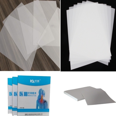 Produtos médicos Impressão a laser Filme branco opaco Filme médico de raios-X Imagem Impressão de filme Para impressora a jato de tinta Epson &amp; Canon