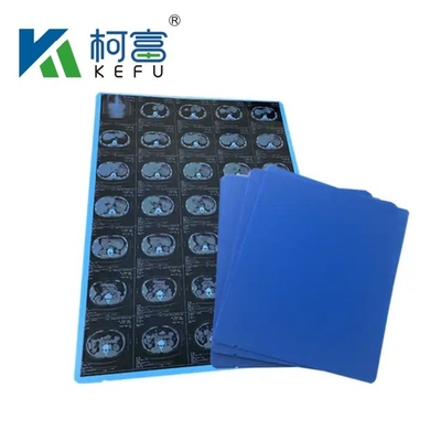 Folhas de tamanho personalizado A3 Rolls Blue Inkjet Medical Film Para Impressão de Imagem Médica CT, CR, DR, MTR
