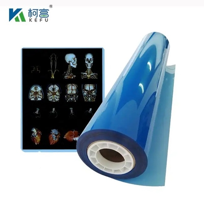 Impressora de jato de tinta de saída de imagem de raio X de filme seco médico azul para máquina médica