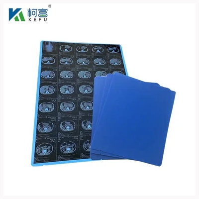 Radiologia PET Filme Médico de Jato de Tinta Seco Azul 8x10 10x12 11x14 14x17 polegadas Filmes de Raios X Ortopédicos Médicos