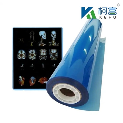 Blue Medical X-ray Dry Film Hospital CT Imagem Médica Inkjet impermeável