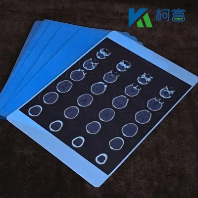 Blue Medical X-ray Dry Film Hospital CT Imagem Médica Inkjet impermeável