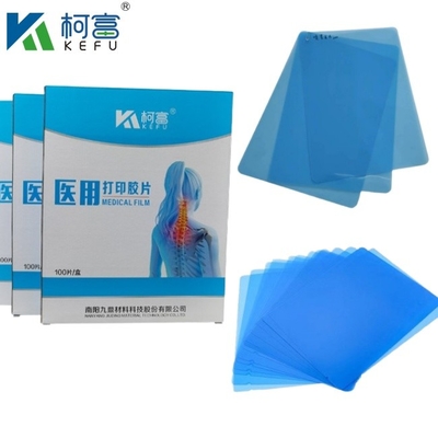 Tamanho personalizado Tinta de jato de azul de raio-X médico filme para Epson A4 A3 PET Seco azul médico laser de raio-X em venda