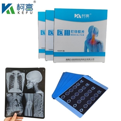 Tamanho personalizado Tinta de jato de azul de raio-X médico filme para Epson A4 A3 PET Seco azul médico laser de raio-X em venda