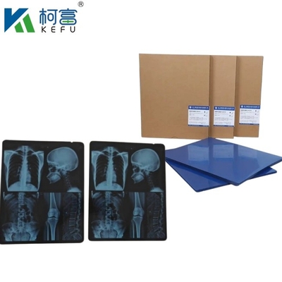 Tamanho personalizado Tinta de jato de azul de raio-X médico filme para Epson A4 A3 PET Seco azul médico laser de raio-X em venda