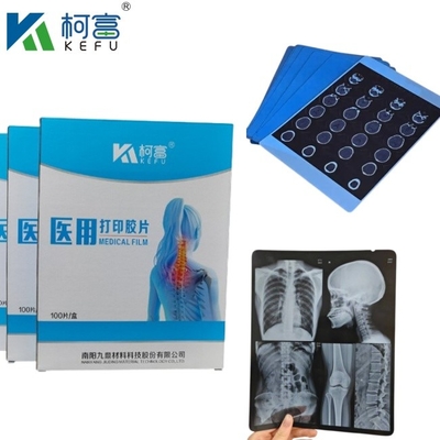 Imagem médica baseada em PET azul de tamanho personalizado, jato de tinta de raios X/ filme laser para clínicas e hospitais