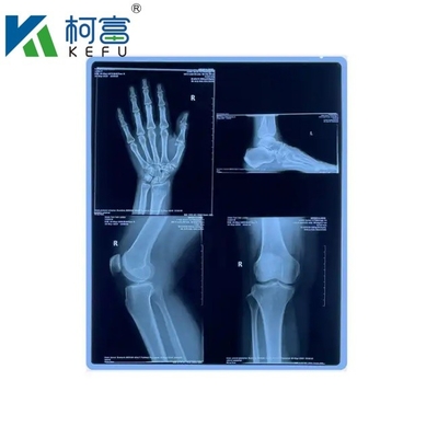 Imagem médica baseada em PET azul de tamanho personalizado, jato de tinta de raios X/ filme laser para clínicas e hospitais