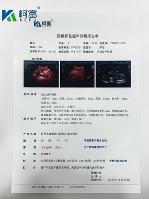 Filme Seco Médico Transparente de Jato de Tinta Filme de Raios-X Branco Para Dispositivo Radiológico CT DR MRI