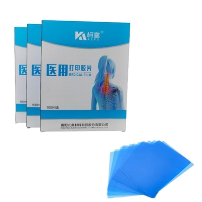 Filme de jato de tinta azul para radiografia médica/CT/DR Filme de varredura seca para impressora de imagem a laser de raios-X e equipamento de impressora de imagem térmica