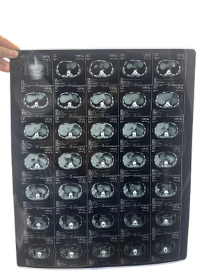 Impressão por jato de tinta de raios X Filme de impressão por jato de tinta seco de raios X para dispositivos médicos