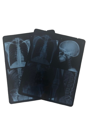 Inkjet Blue Pet Film Impermeável 8*10 10*12 10*14 polegadas PET Xray Blue Sheet Film Médico Para Impressão Digital