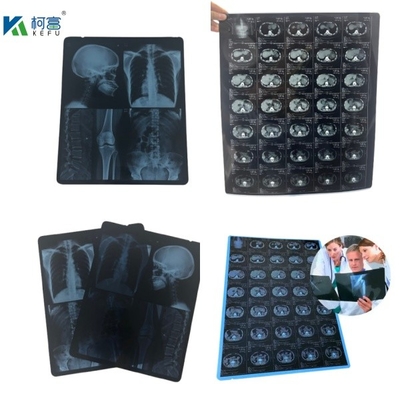 Inkjet Blue Pet Film Impermeável 8*10 10*12 10*14 polegadas PET Xray Blue Sheet Film Médico Para Impressão Digital