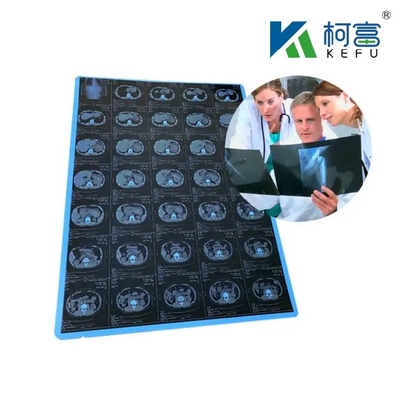 125 Microns Semi - Laser Branco Transparente Médico X - Ray PET Filmes Plásticos Projetados para Excelência em Medicina