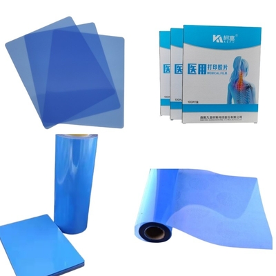 Imagem Médica Seca PET Inkjet Laser Filme de Raios-X Médicos 14x17 polegadas
